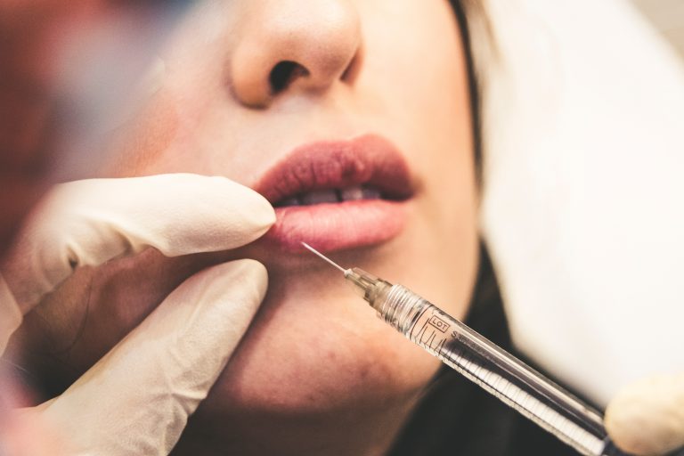 filler acido ialuronico