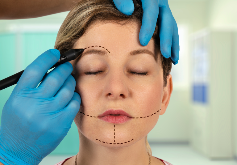 Trattamento con Fili di Biostimolazione in PDO
